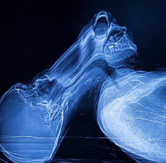A dark, atmospheric digital illustration of a skeletal, ghostly figure with glowing blue energy lines depicting its muscles and sinew, screaming or roaring in what appears to be an X-ray or spirit vision style.