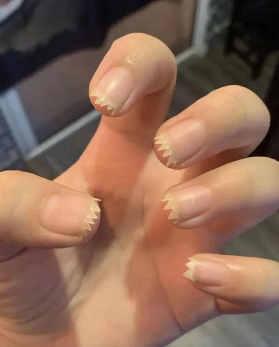A hand with several fingernails cut into jagged, triangular “teeth,” illustrating the Chinese post: “孙学领悟容易，实践很难，普通人先从剪指甲开始” (“Learning Sun-style skills is easy, practice is hard; ordinary people can start by cutting their nails”).