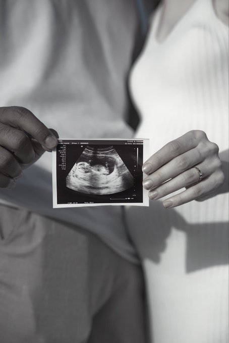 A couple holds up an ultrasound photo together, with visible technical text and measurements along the edges of the image, suggesting they are sharing exciting pregnancy news with their "GM fam."