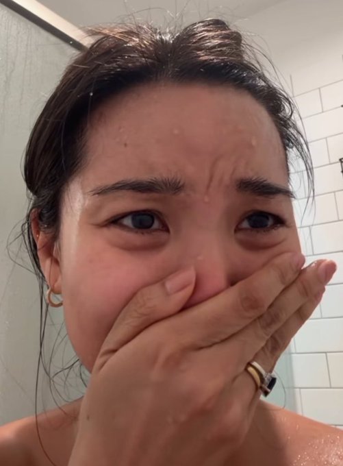 A close-up selfie shows a woman with wet hair covering her mouth with her hand, displaying a ring on her finger and appearing to have irritated skin on her forehead.