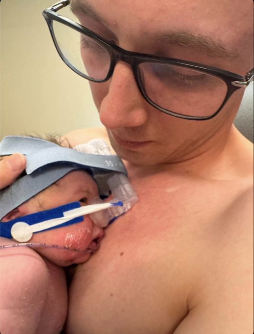 A shirtless man wearing glasses holds his newborn baby, who has a medical tube and is wearing a "35" size cap, against his bare chest in what appears to be a hospital setting.

The image appears unrelated to the post, which is a social media giveaway promising SOL cryptocurrency rewards for engagement on an original post.