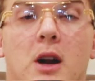 A close-up image shows a person with acne wearing clear-rimmed glasses, eyes wide open and mouth agape in a stunned or horrified expression. The shock on the person's face visually conveys the devastation implied by "topblasting" (heavily losing on) the $LAPTOP stock position.