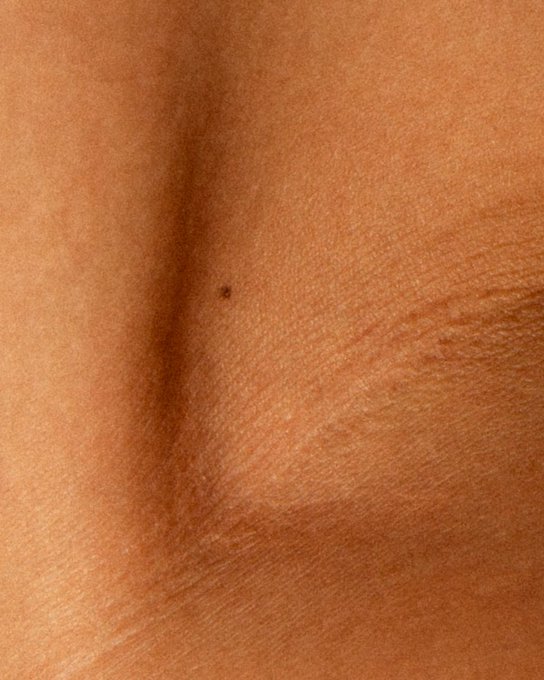 An extreme close-up photograph of human skin showing fine lines, pores, and a small mole or freckle.