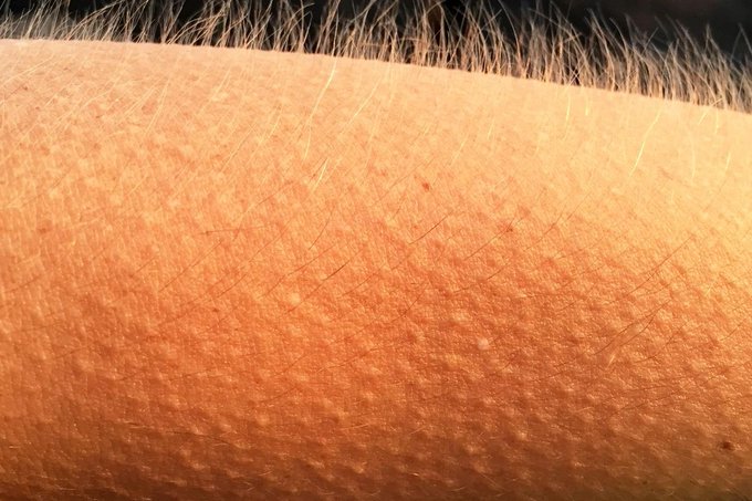 A close-up image of an arm with goosebumps and raised arm hairs against a dark background, visually evoking the phrase "you definitely know your onions" in the post by showing a literal "goosebump" reaction of enthusiasm to the proposal.