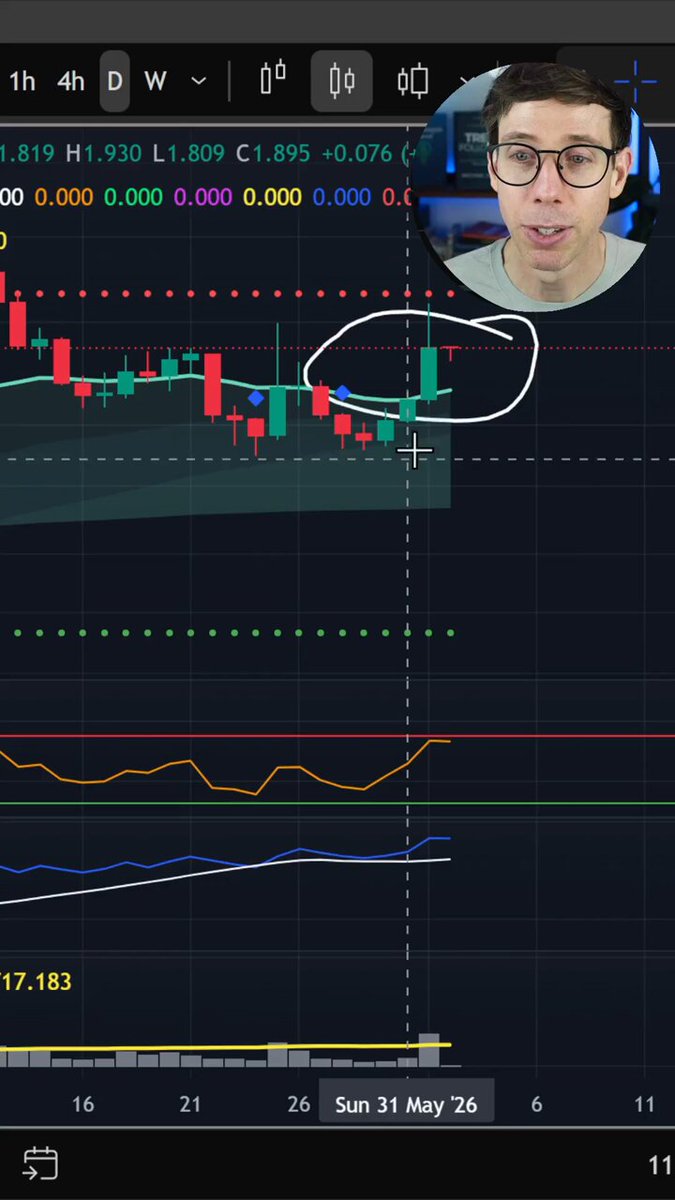 The image features an overlay of a stock chart with a young man's face positioned above a line graph. The person appears to be surprised by the information displayed in front of them, indicating some sort of sudden change or development in the stock market.

A comment on this post suggests that not every green candle should receive attention, and it is important to analyze the data rather than solely relying on emotions. This perspective encourages a more objective and informed approach when dealing with financial markets.