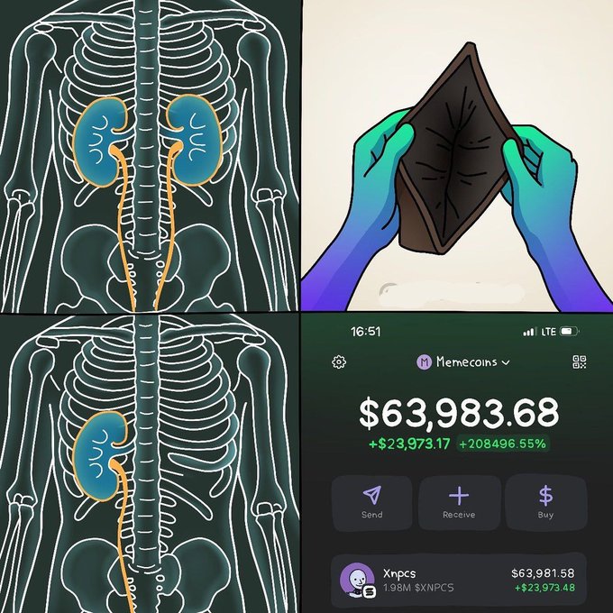 A four-panel image showing two anatomical diagrams of kidneys (one with two kidneys, one with a single kidney), gloved hands holding a dark wallet, and a Phantom wallet screenshot displaying a balance of $63,983.68 in "Memecoins" with a +208,496.55% gain, satirizing the poster's request for the next big memecoin by humorously equating investing in volatile tokens to selling a vital organ.