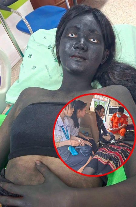 A photo of a person with darkened skin lying down, with an inset image showing medical staff attending to them.