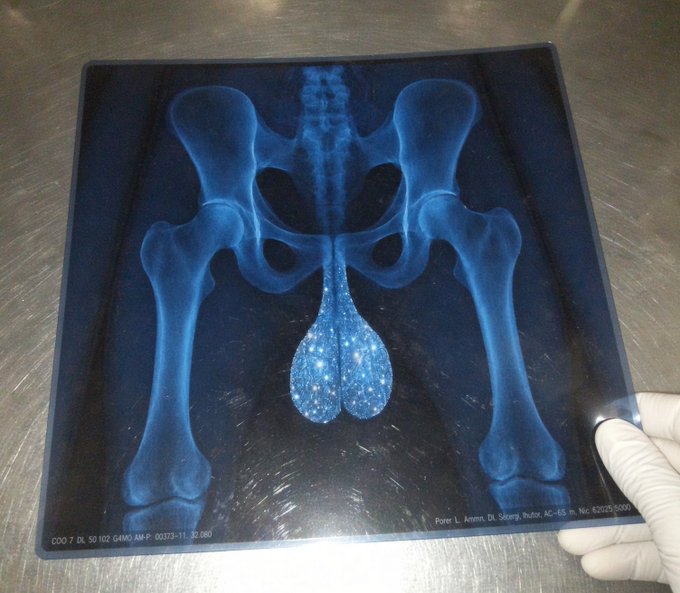 A gloved hand holds an X-ray image of a human pelvis with testicles stylized to resemble two glittering Bitcoin logos, with text "Piner L. Amm. Di. Sicuro, autotutto, AC-45" visible at the bottom, humorously depicting the "hodling" of Bitcoin through testicular imagery.