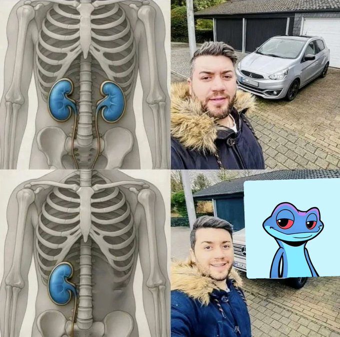 A four-panel collage comparing two skeleton diagrams showing kidneys to two photos of a bearded man in a fur-lined jacket standing in front of a silver car, with a blue cartoon frog overlay on the bottom right image.