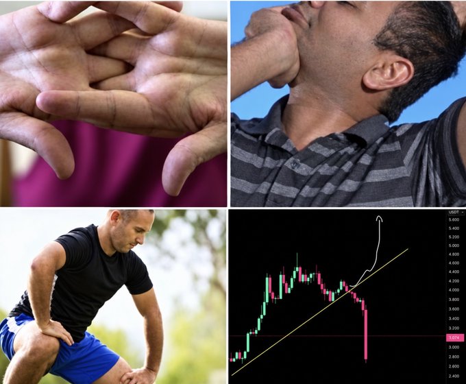 A four-panel collage shows sweaty hands, a man clutching his throat, a man doubled over in apparent physical pain, and a candlestick chart with a sharp downward spike below a rising trendline, visually capturing the physical anguish of watching a leveraged trade reverse sharply. The price scale on the chart ranges roughly from 2.40 to 5.50, emphasizing the violent "rug pull" that turns a degen's hopeful long position into gut-wrenching regret.
