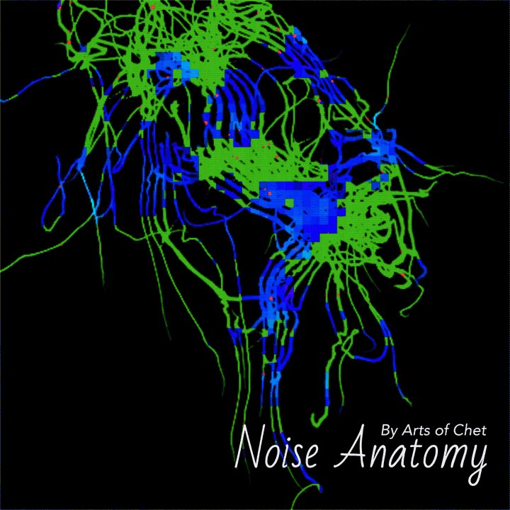 The image features a black background with a close-up view of a computer screen displaying an abstract representation of a brain or nervous system, which appears to be a digital art piece. The text "Noise Anatomy" is written above this image, indicating that it is related to the field of noise anatomy.