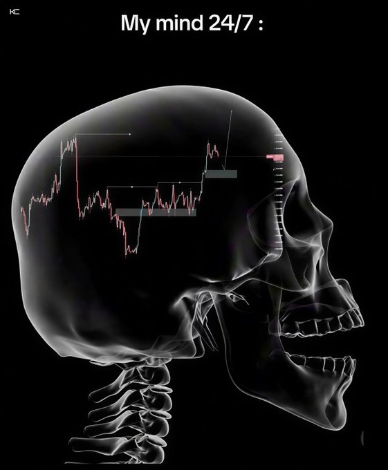 A translucent 3D X-ray skull is shown with candlestick trading charts displayed inside the brain, captioned "My mind 24/7 :" — humorously illustrating how stock market analysis constantly occupies the poster's thoughts, resonating with the "Real" sentiment from fellow traders.