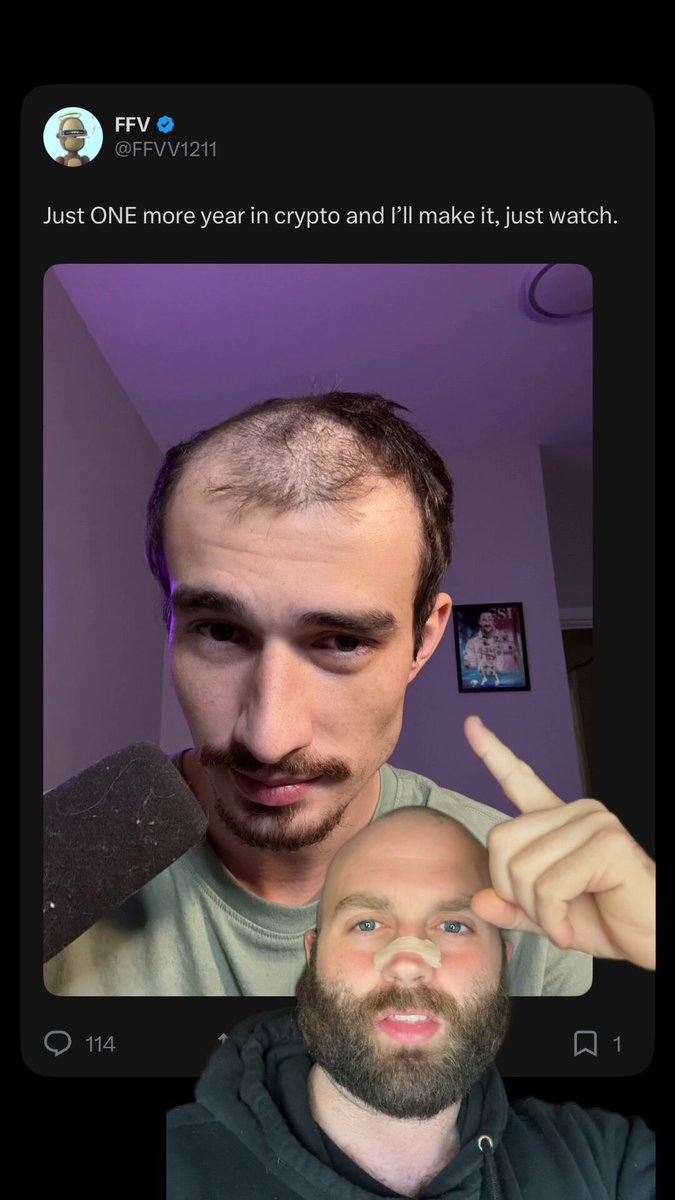 The image features a man with a beard, who appears bald, wearing a black hoodie. The caption of the image reads "Bald News Another crypto bro, yet another hairline speedrunning to baldness. My advice? Just go bald. Take the money you save on haircuts trying to salvage your hair and buy more Bitcoin. Give the @solana ecosystem more money and watch you bags grow during the bear". The man with a beard is positioned in front of a picture frame, which has a picture of another person's head inside it.