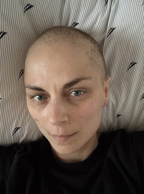 A close-up selfie of a young man with a shaved head lying against a striped pillow.