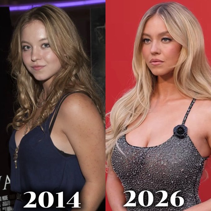 Side-by-side comparison photos labeled '2014' and '2026' showing a young blonde woman, with noticeable changes in styling and appearance.