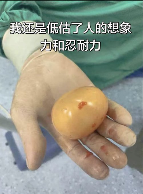 A gloved hand holds a large, smooth, egg-shaped orange stone, with Chinese text overlaid reading "我还是低估了人的想象力和忍耐力" (I still underestimated people's imagination and endurance).