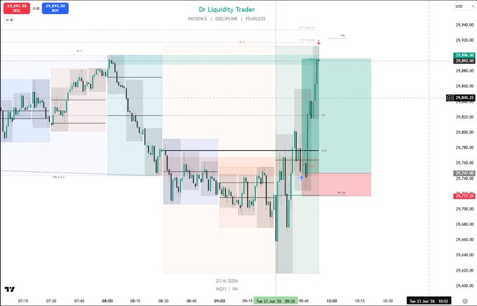 The image shows a chart of stock prices, with a green line indicating the price movement over time. The chart displays various levels of stock trading activity, including a red dot representing a high point or peak in the price movement. The text on the screen reads "DROP YOUR SETUP IN THE COMMENTS AND LET'S COMPARISON READS". This suggests that there is an ongoing discussion about the chart and its implications for investing strategies.