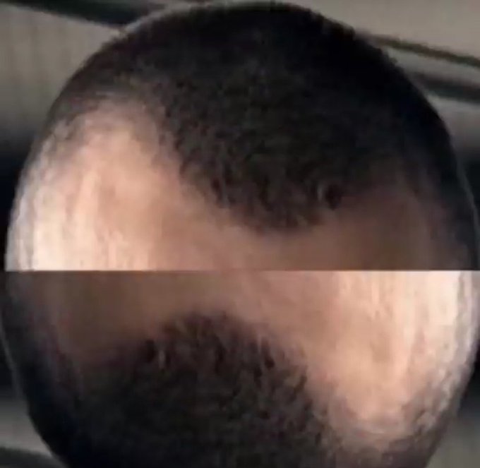 The image features an advertisement with a man's head, which appears to have been photoshopped or edited to create an interesting effect. The background of the image is blurred, making the man's face stand out even more. The caption below the image reads "What a day to be alive $HYPE finally flipped $SOL Let’s see what else life has in store for us". This phrase seems to be a playful commentary on the current state of affairs or an attempt at humor, as it is not clear if this is a genuine statement or part of an advertisement.