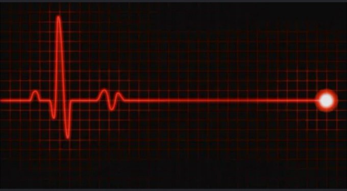 A digital monitor displays a red heartbeat line on a black grid background, with a glowing red dot at the end indicating a flatline or end of signal.