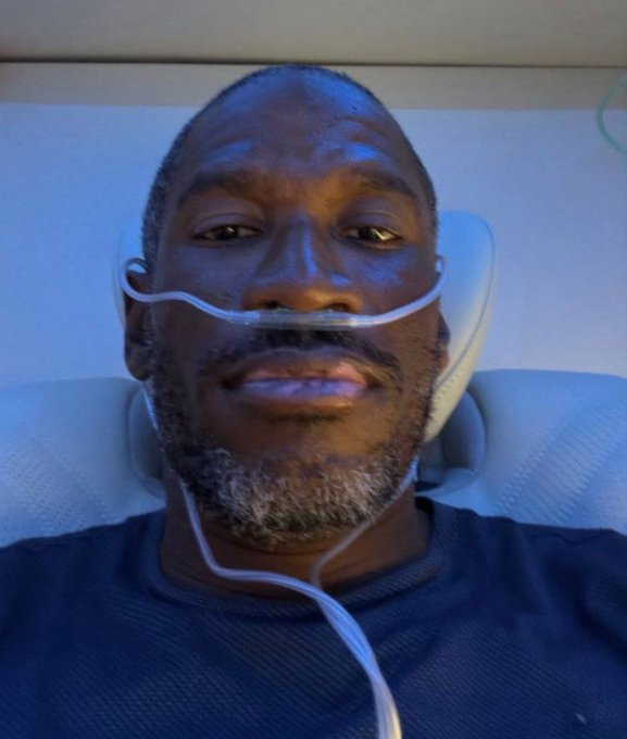 A selfie of a bald man with a graying beard wearing a nasal cannula oxygen tube.