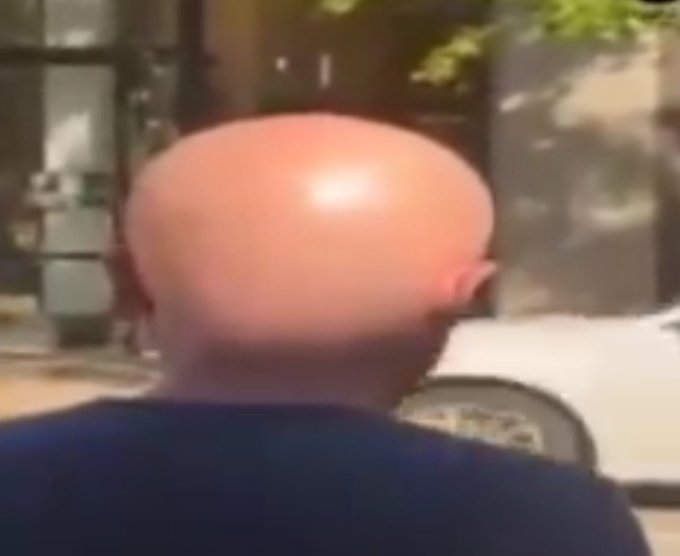 A close-up photograph of a person with a shaved head, viewed from behind, with their head appearing notably shiny and pinkish in tone, wearing a dark blue shirt.
