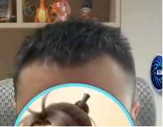 A close-up of a person looking at the camera with a circular inset showing what appears to be an animal.