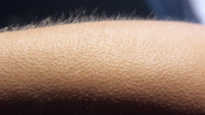 An extreme close-up of human skin showing fine hairs and skin texture.