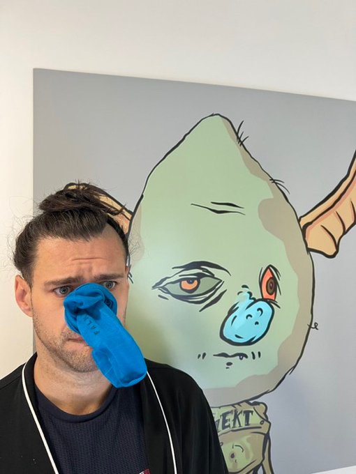 A man with a beard and bun stands in front of a painting of a green creature with horns, holding a blue glove over his face.
