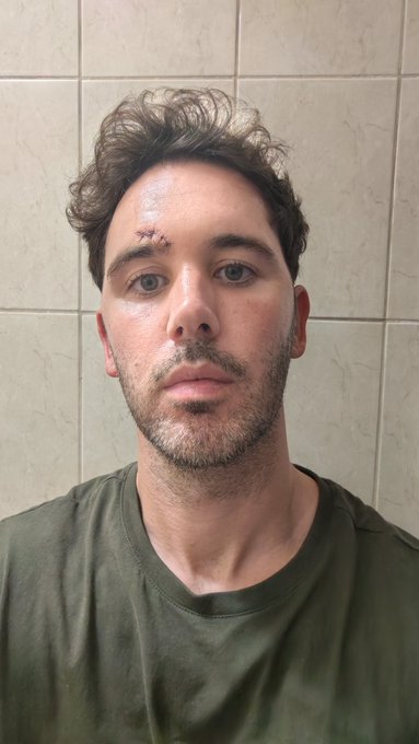 A close-up selfie of a man with curly brown hair, stubble, and a small cut on his forehead, wearing an olive green t-shirt against a tiled wall.