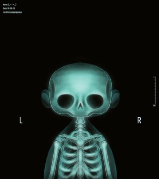 A 3D-rendered teal X-ray style image of a skeleton with an oversized, stylized skull, displayed on a black background with "L" and "R" orientation markers and small text in the top corner. The eerie, oversized skull imagery visually represents the surprising and dramatic surge in NFT sales described in the post.