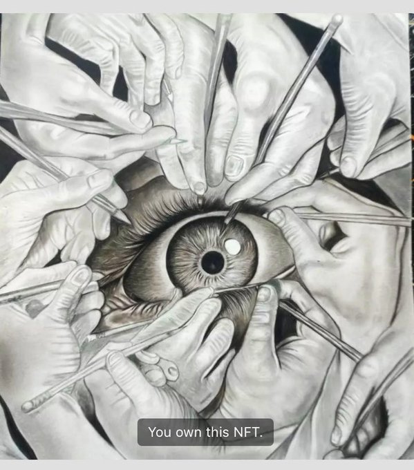 A surreal grayscale artwork showing a human eye surrounded by many pale hands holding surgical instruments and probes, with a label reading "You own this NFT."