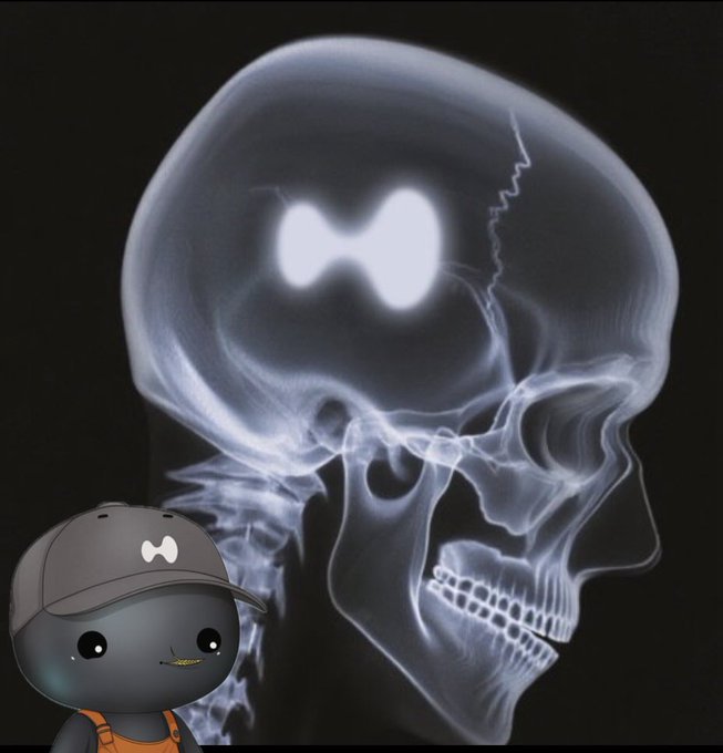 A stylized X-ray of a skull with a glowing butterfly-shaped cavity in the brain is displayed alongside a cartoon character wearing a "Hyper" cap, playfully illustrating the post's theme of speculating on which HyperEVM tokens, memes, or NFTs to buy — as if the decision is weighing heavily on one's mind.