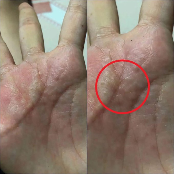 Two close-up images showing the palm of a hand, with the right image featuring a red circle highlighting a specific area in the center of the palm, showing a unique pattern of lines.