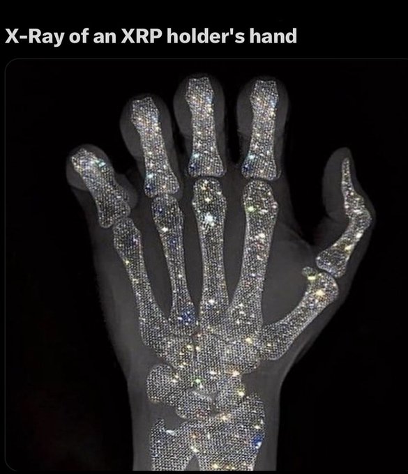 The image features an x-ray of a person's hand with their fingers spread out, revealing a unique design made up of small diamonds or other shiny materials. The background of the image is black, which contrasts with the white hand and adds emphasis on the hand's intricate design. The caption below the image reads "X-Ray of an XRP holder's hand", indicating that this image might be related to the XRP currency or a discussion about the XRP holders' experience.