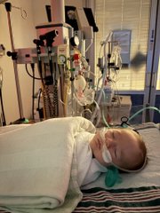 A young child lies in a hospital bed surrounded by extensive medical equipment, monitors, and IV lines.