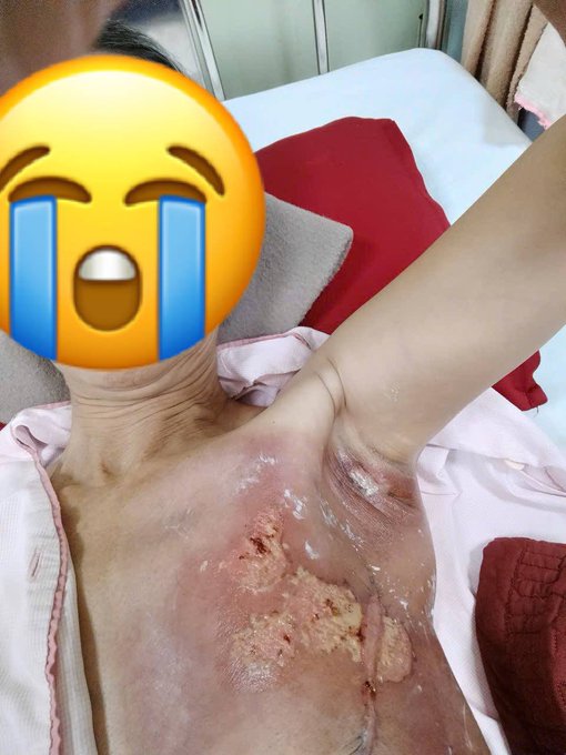 The image shows a person's chest with a crying emoji covering their face, likely illustrating the distress associated with the visible wound. The accompanying post offers support and 1 BNB (a cryptocurrency) for a speedy recovery.