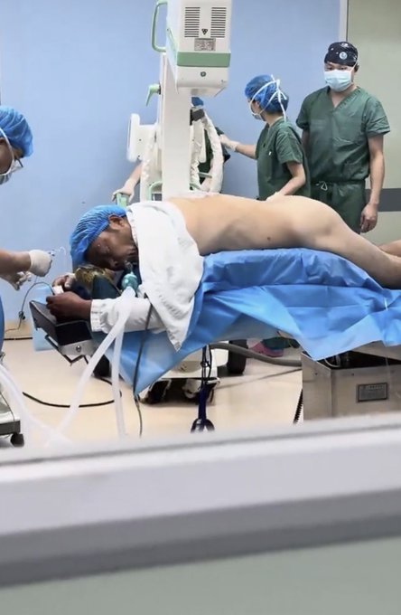 A patient undergoing a medical procedure, lying face down on an operating table while medical staff in scrubs and masks assist with equipment.