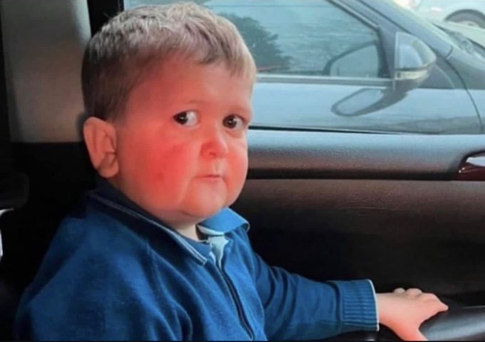 A photo of a young boy with rosy cheeks and a skeptical expression, wearing a blue zip-up sweater, sitting in what appears to be a car.