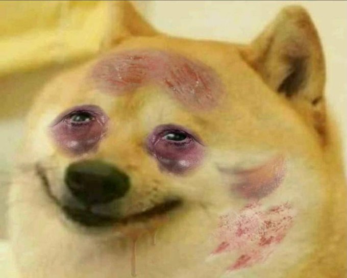 A close-up photo of a Shiba Inu dog with severe bruising and swelling around both eyes, and visible abrasions on its forehead and cheek.