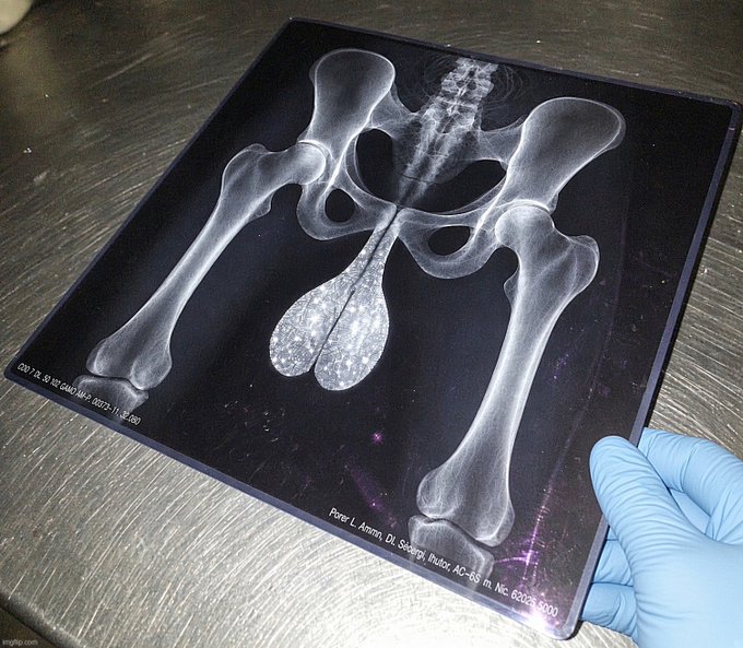 An X-ray of a pelvis with a thumbs-up gesture from a blue-gloved hand, with the text "Peter L Amm, DVM, SUNY Buffalo, AC-65 in, NE 6302 3000" visible, humorously illustrating Bitcoin investors who bought at $56,000 like they're celebrating despite apparent "anatomical damage"—suggesting their investment may have left them in pieces, yet they're still putting on a brave face.