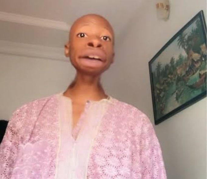 A woman with alopecia wearing a pink and white top speaking directly to the camera in a home setting.