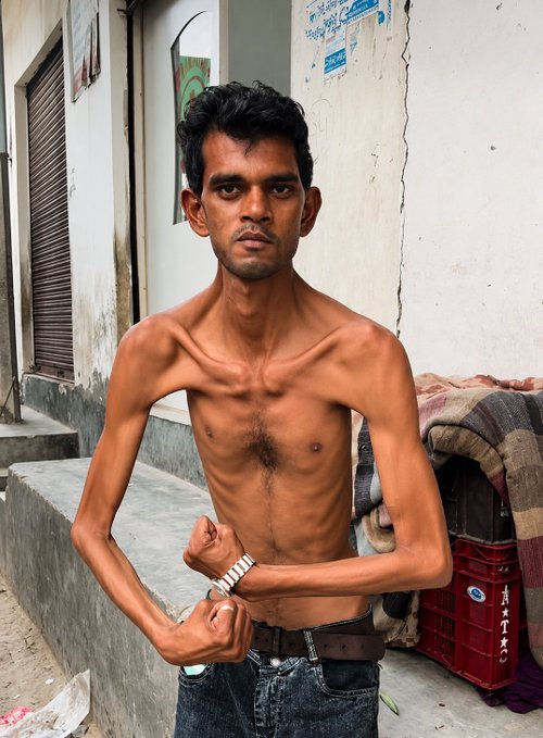 A shirtless, very lean young man flexing his arms to show off prominent veins and defined muscles, standing on a street with weathered walls and a red crate behind him.