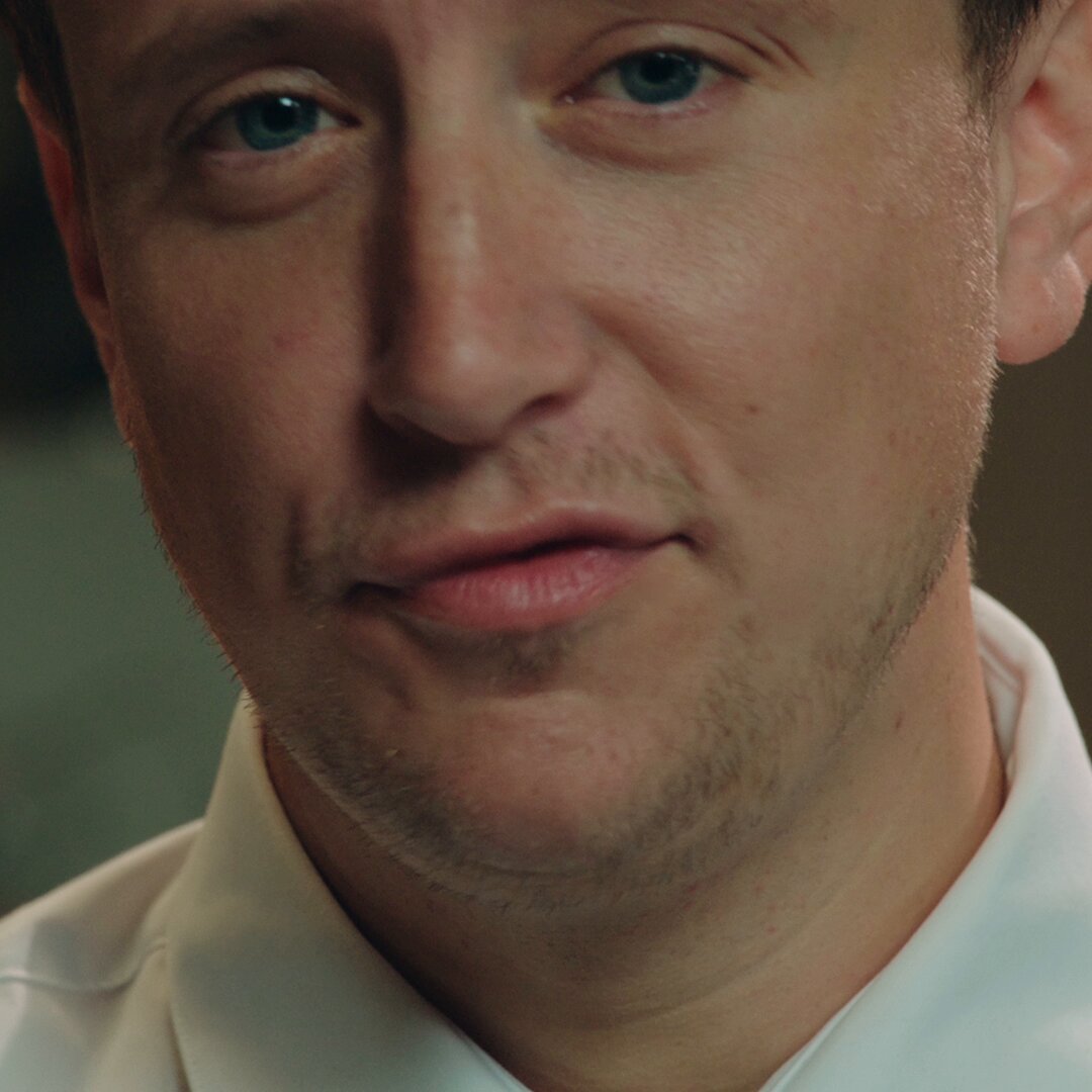 The image shows a close-up of a man's face, specifically his chin area. The man has short hair and is wearing a white shirt. There are no texts or other objects visible in the image.