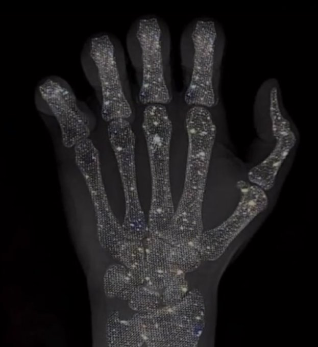 An X-ray image of a hand where the bones appear to be composed of a sparkling, jewel-encrusted, or crystalline texture against a black background.