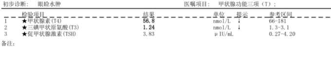 The image shows a table with Chinese characters written on it. The text appears to be in English as well, but the specific content of the table cannot be determined from the image alone.