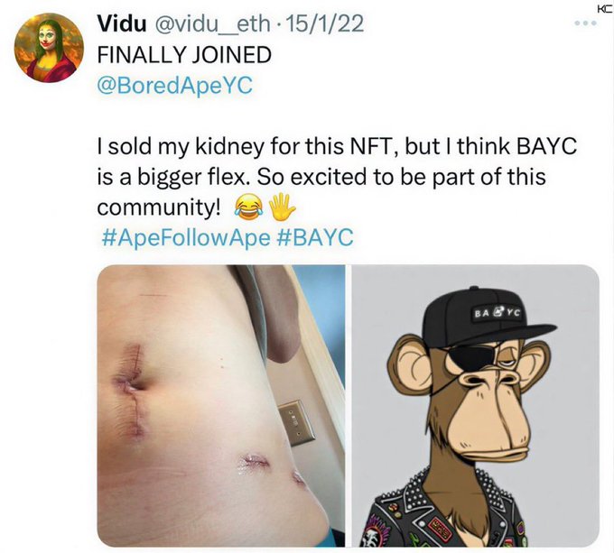 The image shows a tweet from user "Vidu @vidu_eth" dated 15/1/22 announcing "FINALLY JOINED @BoredApeYC" with the caption "I sold my kidney for this NFT, but I think BAYC is a bigger flex. So excited to be part of this community!" accompanied by a photo of a surgical scar on a torso next to a Bored Ape NFT image wearing a BAYC cap. The post warns about FOMO-driven behavior, as the tweet illustrates extreme measures—allegedly selling a kidney—to afford NFT membership, reinforcing the caution to "always look before you leap."