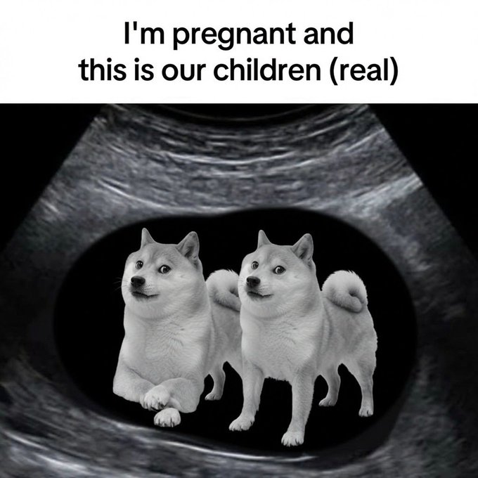 The image is a humorous ultrasound-style meme featuring two Shiba Inu dogs photoshopped into a black oval as if they were fetuses, with the text "I'm pregnant and this is our children (real)" displayed at the top.