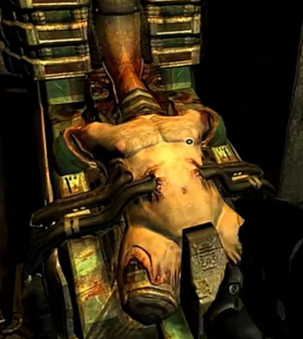 A grotesque scene from a video game showing a humanoid figure strapped to a mechanical device with metal bands, with their skin peeled back to expose the body underneath.