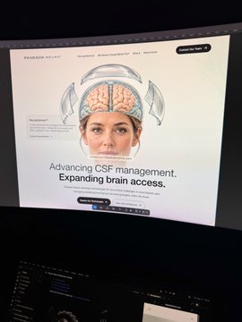 A photograph of a monitor displaying a Paramount Plus webpage advertisement featuring a woman with a transparent head showing a brain, with text reading 'Advancing CSF management. Expanding brain access.'