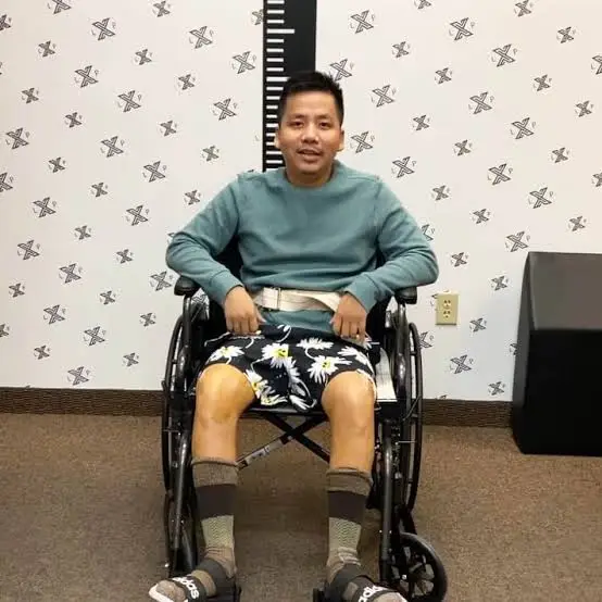 A man sits in a wheelchair wearing a blue sweatshirt and floral shorts, smiling in a room with patterned wallpaper and a height measurement chart behind him.